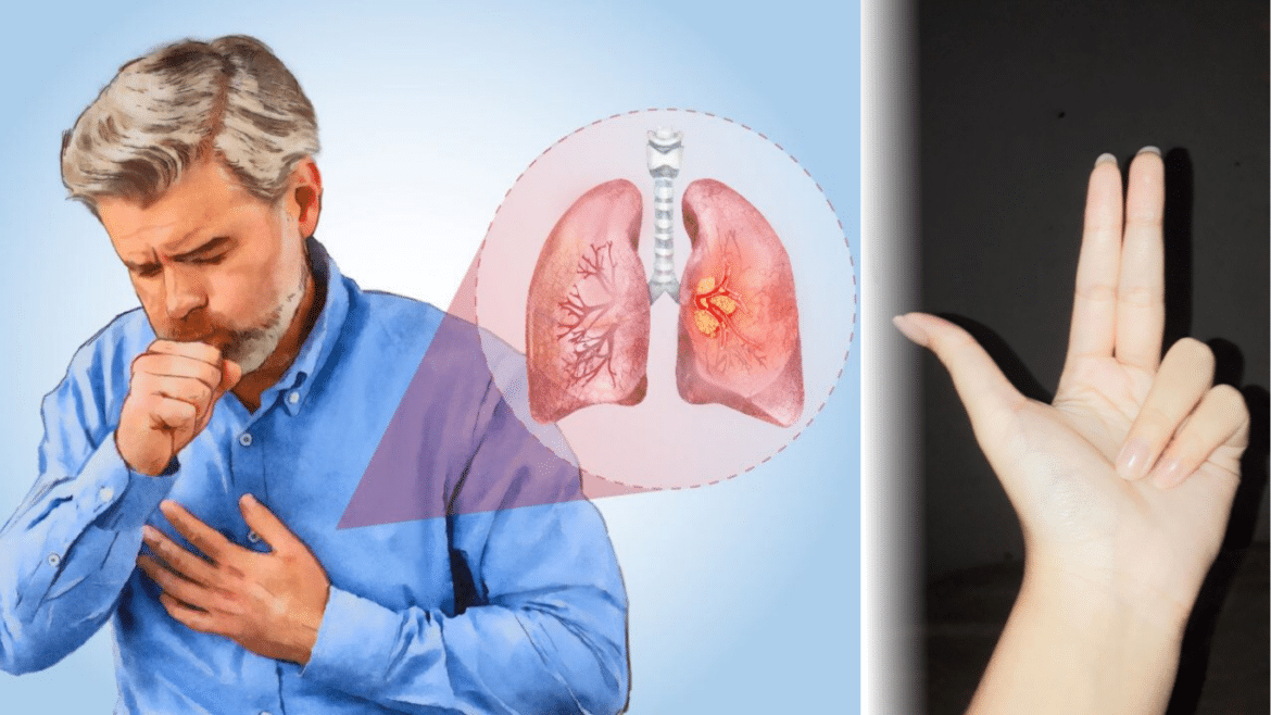 Quick At‑Home ‘Finger Test’ Can Reveal Early Signs of Lung Cancer — What You Need to Know
