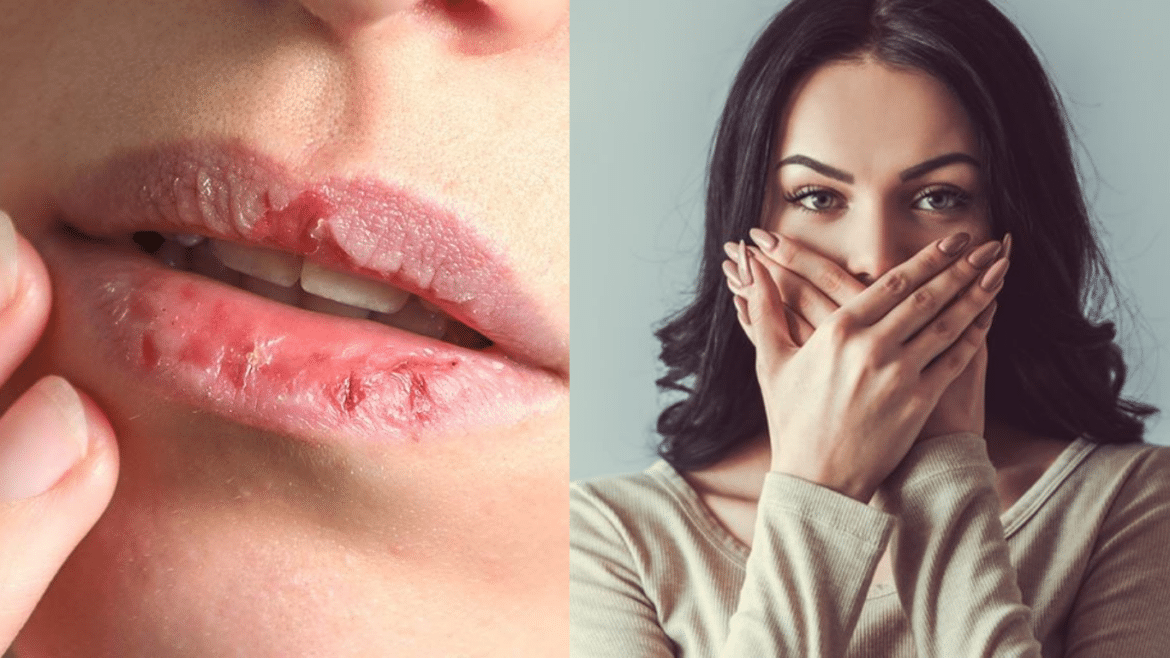 How come TayaHealth Warning: Constantly Dry, Cracked Lips Could Be a Sign of Something More Serious — Here’s What to Watch Forlor Swift gave Travis Kelce a chance everything gets spilled × ()