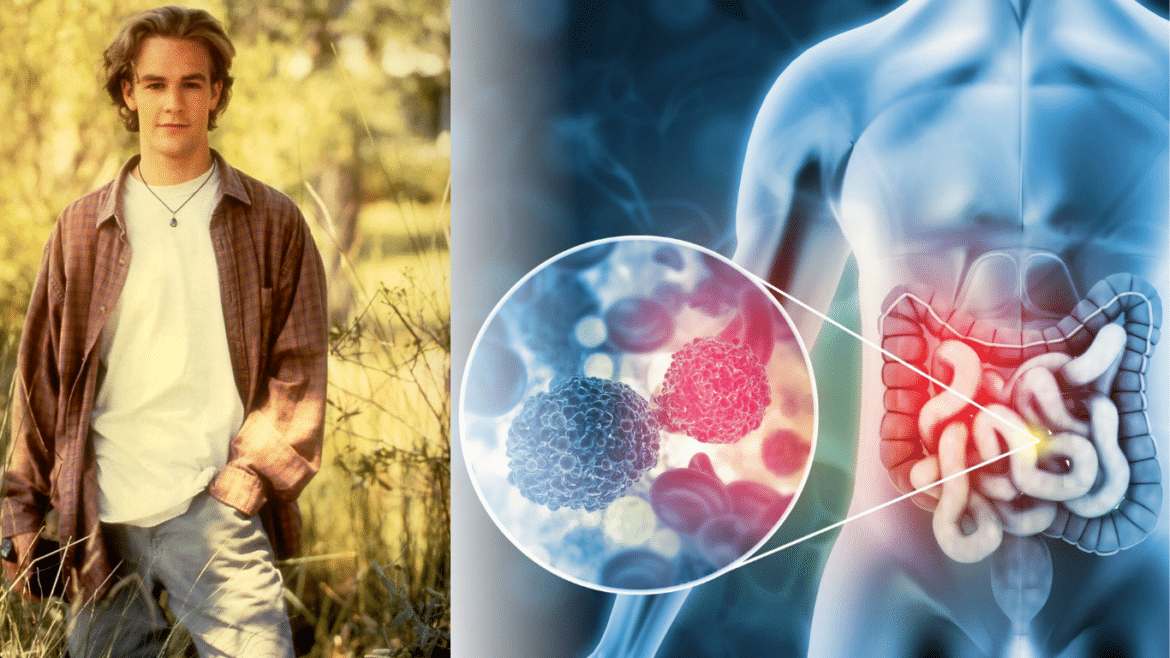 5 Bowel Cancer Symptoms to Know — Including the Warning Sign James Van Der Beek Initially Ignored